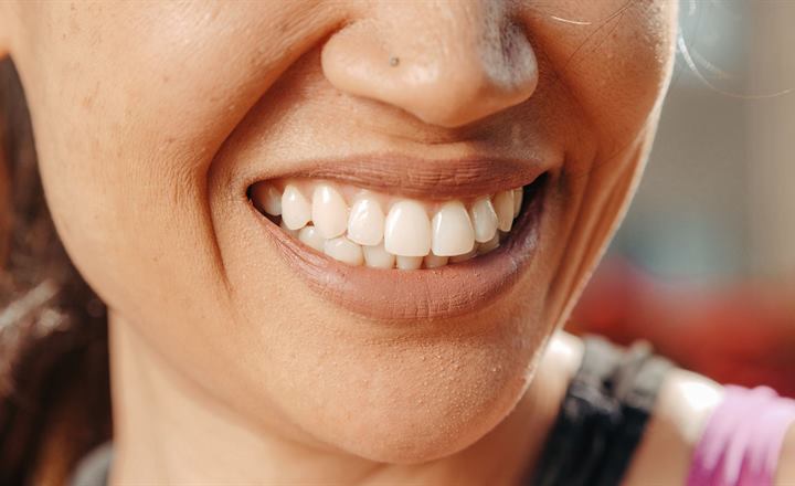 Close-up of a natural, confident smile