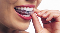Invisalign Invisible Braces